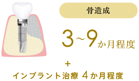 骨造成に3〜9ヶ月程度、インプラント治療4ヶ月程度