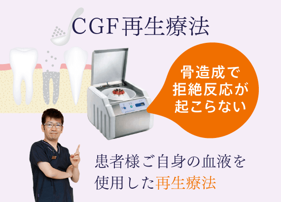 CGF再生療法 患者様ご自身の血液を使用した再生療法