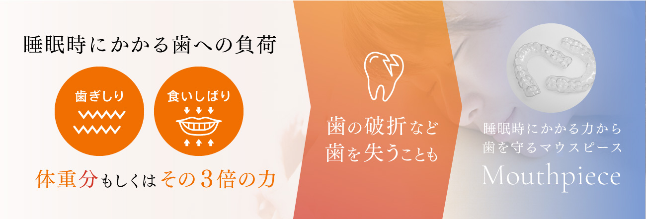 「歯ぎしり」「食いしばり」で睡眠時にかかる歯への負荷は体重分もしくはその3倍の力