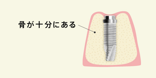 骨が十分にある