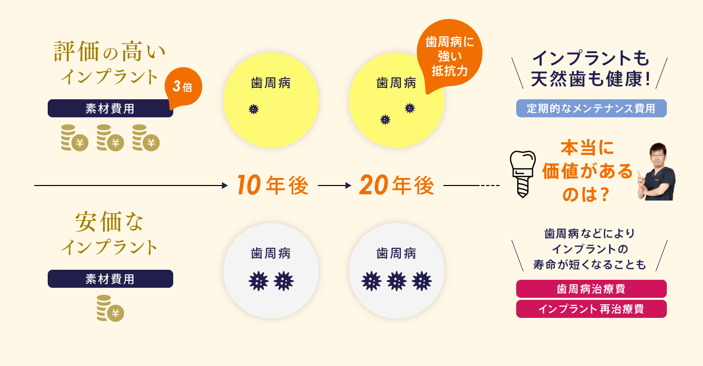 評価の高いインプラントと安価なインプラントの違い